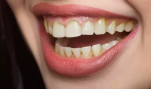 The Best Ways To Fix Yellow Teeth At Home