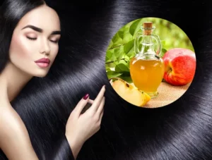 Sour Power : Apple Cider Vinegar Benefits For Hair