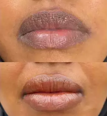 lip lightening cream